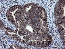m04131 anti snon skil mouse monoclonal antibody clone id oti2f6 ihc testing 6