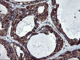 m04131 anti snon skil mouse monoclonal antibody clone id oti2f6 ihc testing 7