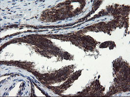 m04131 anti snon skil mouse monoclonal antibody clone id oti2f6 ihc testing 8