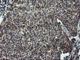m04131 anti snon skil mouse monoclonal antibody clone id oti2f6 ihc testing 9