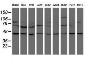 m04131 anti snon skil mouse monoclonal antibody clone id oti2f6 wb testing 2