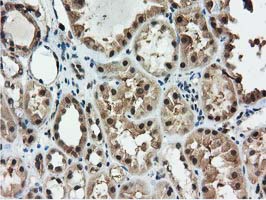 m04147 1 anti ribonuclease inhibitor rnh1 mouse monoclonal antibody clone id oti3f11 ihc testing 11