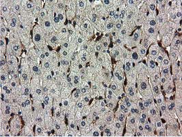 m04147 1 anti ribonuclease inhibitor rnh1 mouse monoclonal antibody clone id oti3f11 ihc testing 12