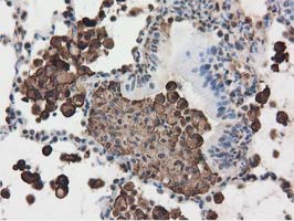 m04147 1 anti ribonuclease inhibitor rnh1 mouse monoclonal antibody clone id oti3f11 ihc testing 3