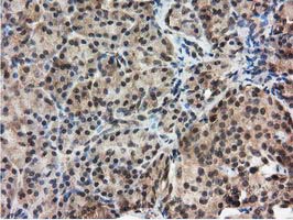 m04147 1 anti ribonuclease inhibitor rnh1 mouse monoclonal antibody clone id oti3f11 ihc testing 4