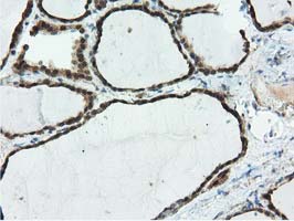 m04147 1 anti ribonuclease inhibitor rnh1 mouse monoclonal antibody clone id oti3f11 ihc testing 5
