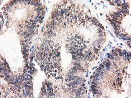 m04147 1 anti ribonuclease inhibitor rnh1 mouse monoclonal antibody clone id oti3f11 ihc testing 6