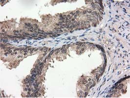 m04147 1 anti ribonuclease inhibitor rnh1 mouse monoclonal antibody clone id oti3f11 ihc testing 7