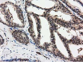 m04147 1 anti ribonuclease inhibitor rnh1 mouse monoclonal antibody clone id oti3f11 ihc testing 8