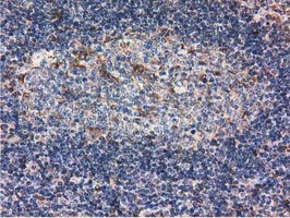 m04147 1 anti ribonuclease inhibitor rnh1 mouse monoclonal antibody clone id oti3f11 ihc testing 9