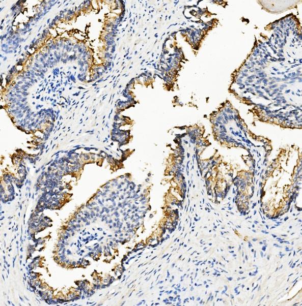 m04147 rnh1 primary antibodies ihc testing 4