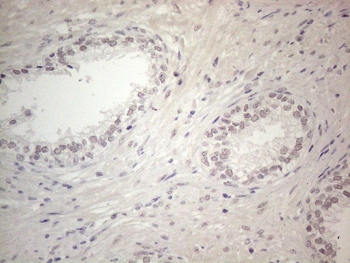 m04153 anti ercc8 mouse monoclonal antibody clone id oti2g1 ihc testing 4