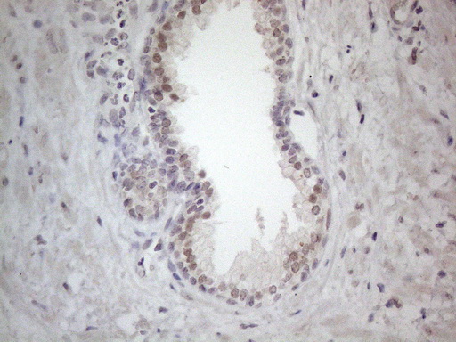 m04153 anti ercc8 mouse monoclonal antibody clone id oti2g1 ihc testing 5
