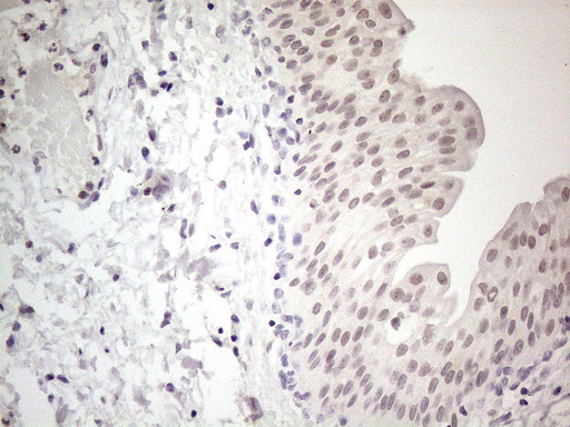 m04153 anti ercc8 mouse monoclonal antibody clone id oti2g1 ihc testing 6