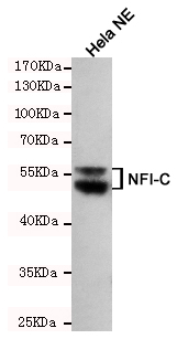 m04154 nfic primary antiboties wb testing 1