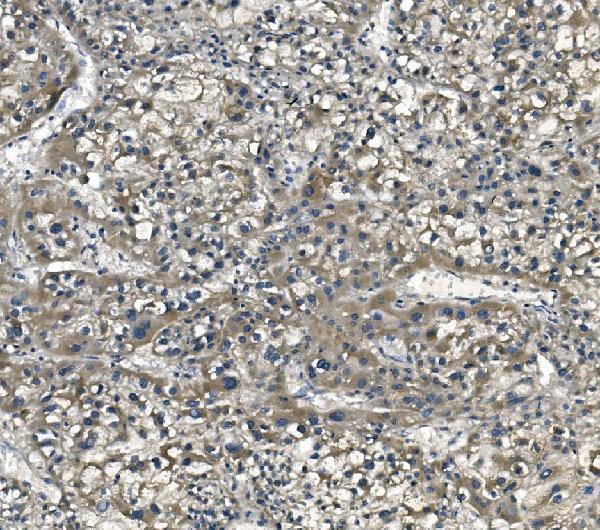 m04157 1 etf1_erf1 primary antibodies ihc testing 5
