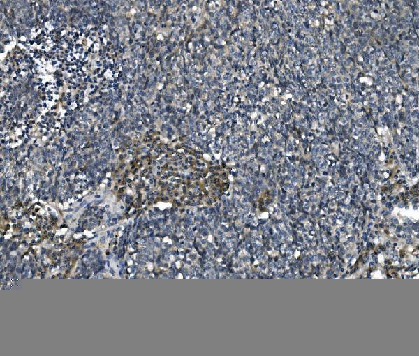 m04157 1 etf1_erf1 primary antibodies ihc testing 6