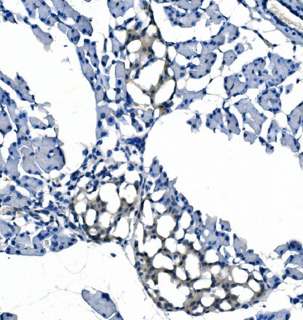 m04157 1 etf1_erf1 primary antibodies ihc testing 7