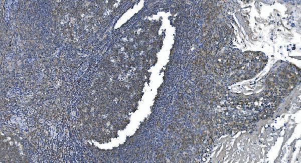 m04157 etf1 primary antibodies ihc testing 2