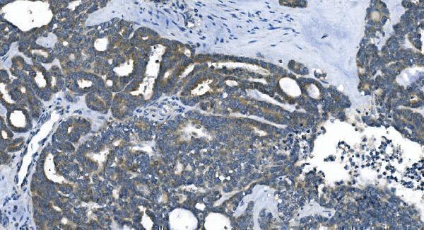 m04157 etf1 primary antibodies ihc testing 3