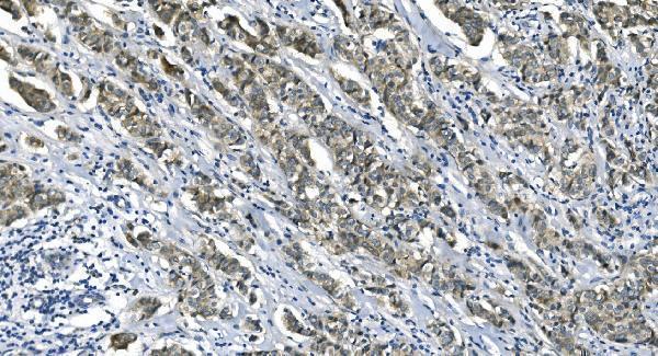 m04157 etf1 primary antibodies ihc testing 4