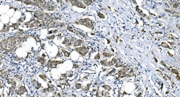 m04157 etf1 primary antibodies ihc testing 5