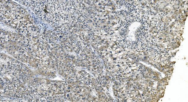 m04157 etf1 primary antibodies ihc testing 6