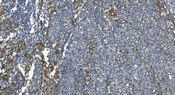 m04157 etf1 primary antibodies ihc testing 7