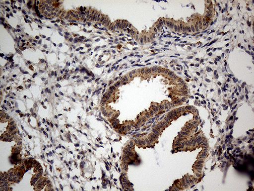 m04163 anti naga mouse monoclonal antibody clone id oti3a4 ihc testing 2