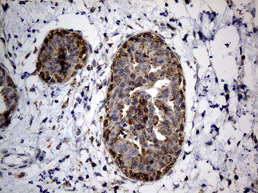 m04163 anti naga mouse monoclonal antibody clone id oti3a4 ihc testing 3