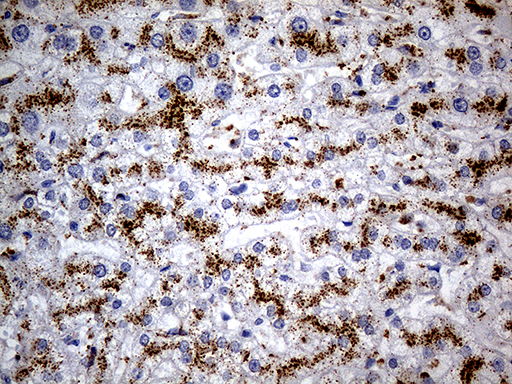 m04163 anti naga mouse monoclonal antibody clone id oti3a4 ihc testing 5