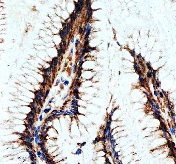 m04168 hsph1 primary antibodies ihc testing 3