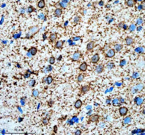 m04168 hsph1 primary antibodies ihc testing 4