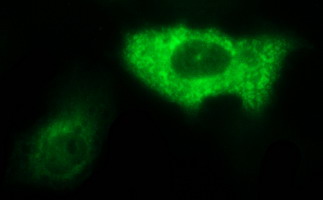 Anti-AMOT mouse monoclonal antibody (M04170-1) immunofluorescent staining of COS7 cells transiently transfected by pCMV6-ENTRY AMOT