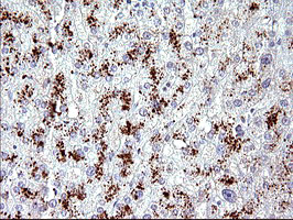 Immunohistochemical staining of paraffin-embedded Human liver tissue within the normal limits using anti-AMOT mouse monoclonal antibody