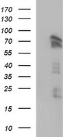 HEK293T cells were transfected with the pCMV6-ENTRY control (Left lane) or pCMV6-ENTRY AMOT (Right lane) cDNA for 48 hrs and lysed