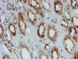 m04174 1 anti sat2 mouse monoclonal antibody clone id oti2b3 ihc testing 10