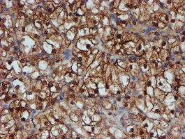 m04174 1 anti sat2 mouse monoclonal antibody clone id oti2b3 ihc testing 11