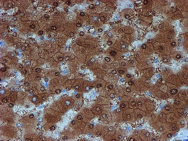 m04174 1 anti sat2 mouse monoclonal antibody clone id oti2b3 ihc testing 12