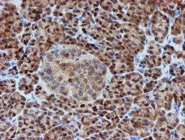 m04174 1 anti sat2 mouse monoclonal antibody clone id oti2b3 ihc testing 4