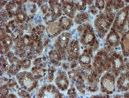 m04174 1 anti sat2 mouse monoclonal antibody clone id oti2b3 ihc testing 5