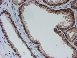 m04174 1 anti sat2 mouse monoclonal antibody clone id oti2b3 ihc testing 7