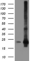 HEK293T cells were transfected with the pCMV6-ENTRY control (Left lane) or pCMV6-ENTRY SAT2 (Right lane) cDNA for 48 hrs and lysed