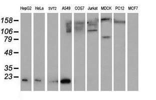 Western blot analysis of extracts (35ug) from 9 different cell lines by usin g anti-SAT2 monoclonal antibody (HepG2: human; HeLa: human; SVT2: mouse; A549: human; COS7: monkey; Jurkat: human; MDCK: canine; PC12: rat; MCF7: human)