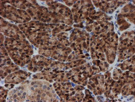 m04174 anti sat2 mouse monoclonal antibody clone id oti1c9 ihc testing 2