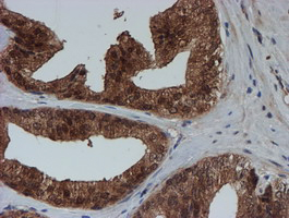 m04174 anti sat2 mouse monoclonal antibody clone id oti1c9 ihc testing 4