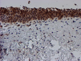 m04174 anti sat2 mouse monoclonal antibody clone id oti1c9 ihc testing 5