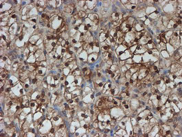 m04174 anti sat2 mouse monoclonal antibody clone id oti1c9 ihc testing 7