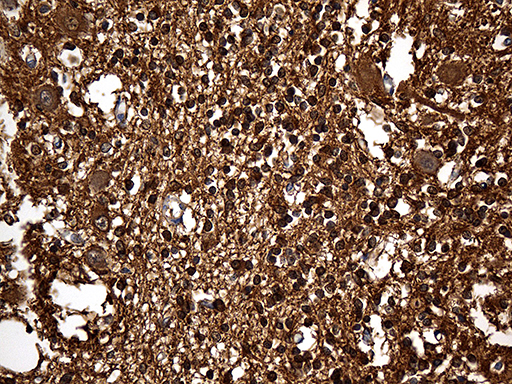 m04179 anti gdi1 mouse monoclonal antibody clone id oti1b1 ihc testing 3