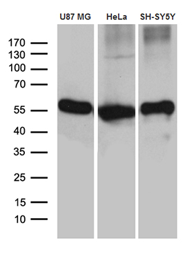 m04179 anti gdi1 mouse monoclonal antibody clone id oti1b1 wb testing 2